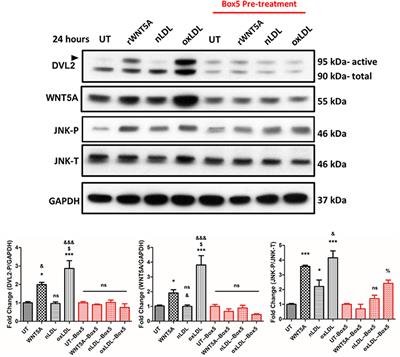 Oxidized Low-Density Lipoprotein Induces WNT5A Signaling Activation in THP-1 Derived Macrophages and a Human Aortic Vascular Smooth Muscle Cell Line